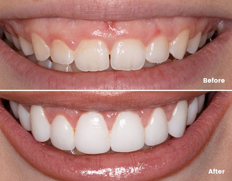 Smile Enhancement & Cosmetic Treatment - Trinidad Periodontal Center